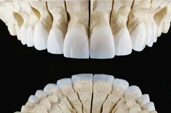 لامینیت سرامیکی